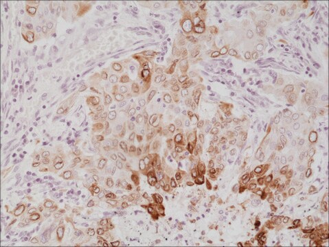 Anti-COX-2 antibody, Rabbit monoclonal recombinant, expressed in HEK 293 cells, clone RM348, purified immunoglobulin