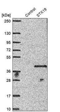 Anti-STX19 antibody produced in rabbit Prestige Antibodies&#174; Powered by Atlas Antibodies, affinity isolated antibody, buffered aqueous glycerol solution