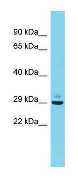 Anti-Pcsk1n (N-terminal) antibody produced in rabbit affinity isolated antibody