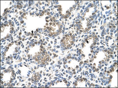 Anti-TST antibody produced in rabbit affinity isolated antibody