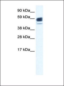 Anti-CHRNA1 (AB2) antibody produced in rabbit affinity isolated antibody