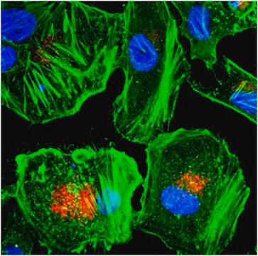 Anticuerpo anti-LBPA, clon 6C4 clone 6C4, from mouse