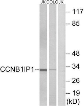 Anti-CCNB1IP1 antibody produced in rabbit affinity isolated antibody