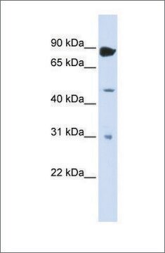 Anti-ADARB1 antibody produced in rabbit affinity isolated antibody