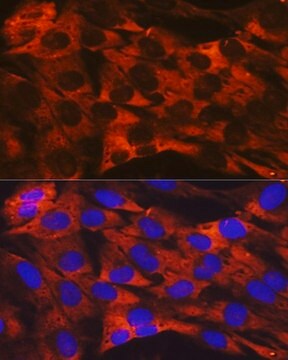 Anti-RPS19 antibody produced in rabbit