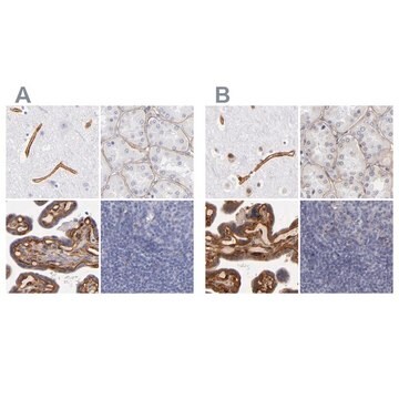 抗LAMC1 ウサギ宿主抗体 Ab2, Prestige Antibodies&#174; Powered by Atlas Antibodies, affinity isolated antibody, buffered aqueous glycerol solution