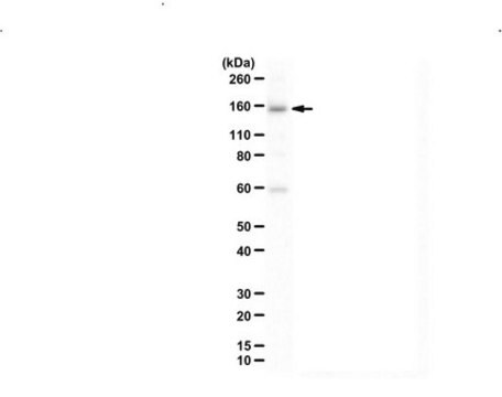 Anti-UTX (KDM6A) from rabbit, purified by affinity chromatography