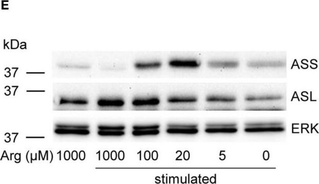 抗ASS1 ウサギ宿主抗体 Prestige Antibodies&#174; Powered by Atlas Antibodies, affinity isolated antibody, buffered aqueous glycerol solution, Ab1