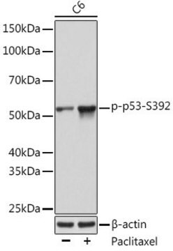 Anti-Phospho-p53-S392 antibody produced in rabbit