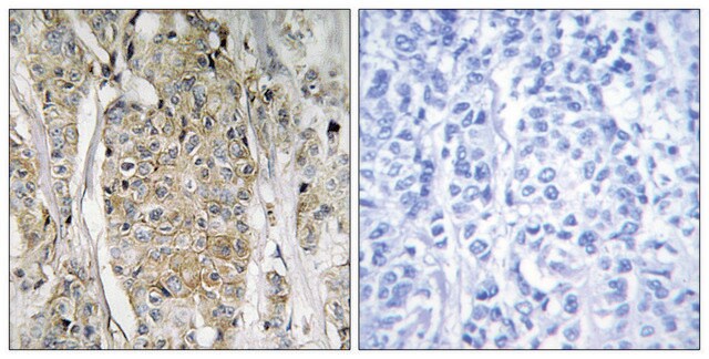 抗-HER2 兔抗 affinity isolated antibody