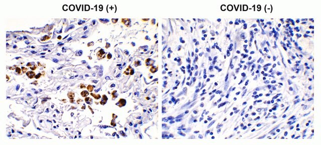 Anti-SARS-CoV-2 (COVID-19) Spike S2 antibody produced in rabbit affinity isolated antibody