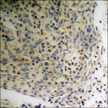 Anti-phospho-p47 phox (pSer359) antibody produced in rabbit affinity isolated antibody