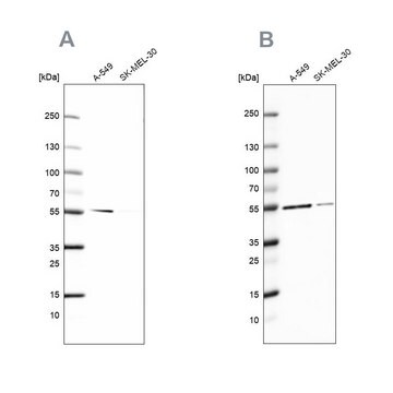 抗GPI抗体 ウサギ宿主抗体 Prestige Antibodies&#174; Powered by Atlas Antibodies, affinity isolated antibody