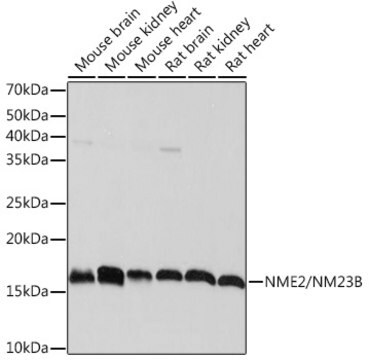 Anti-NME2/NM23B Antibody, clone 7L3A2, Rabbit Monoclonal