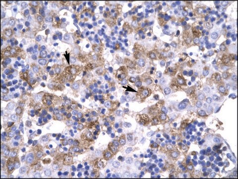 Anti-POU1F1 antibody produced in rabbit affinity isolated antibody