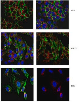 Anticorpo anti-Tom20/Tomm20, clone 2F8.1 clone 2F8.1, from mouse