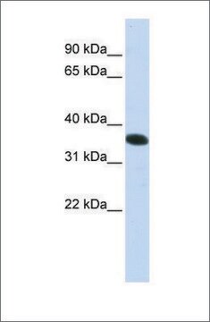 Anti-C21ORF59 antibody produced in rabbit affinity isolated antibody