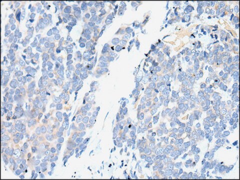 Anti-SMC2 affinity isolated antibody