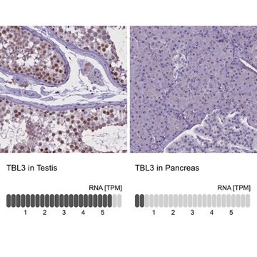 Anti-TBL3 antibody produced in rabbit affinity isolated antibody, buffered aqueous glycerol solution