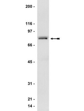 Anticuerpo anti-GRK 2/3 (&#946;ARK 1/2), clon C5/1.1 clone C5/1.1, Upstate&#174;, from mouse