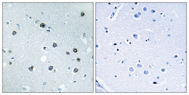 Anti-MYO1D antibody produced in rabbit affinity isolated antibody