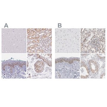 抗SYNE2 ウサギ宿主抗体 Prestige Antibodies&#174; Powered by Atlas Antibodies, affinity isolated antibody, buffered aqueous glycerol solution