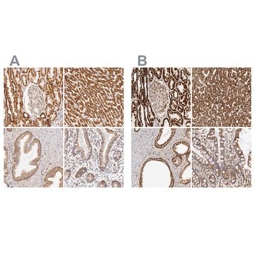 Anti-ATP5B antibody produced in rabbit Ab1, Prestige Antibodies&#174; Powered by Atlas Antibodies, affinity isolated antibody, buffered aqueous glycerol solution