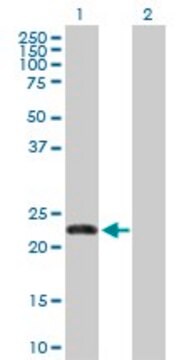 Anti-FBXO36 antibody produced in rabbit purified immunoglobulin, buffered aqueous solution