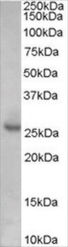 Anti-KIP1/CDKN1B, Internal antibody produced in goat affinity isolated antibody, buffered aqueous solution