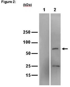 RIPAb+-IGF2-mRNA-Bindungsprotein&nbsp;3 – RIP-validierte-Antikörper- und Primer-Set from rabbit, purified by affinity chromatography