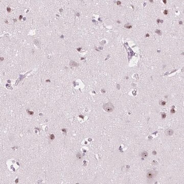 Anti-NOLC1 antibody produced in rabbit Prestige Antibodies&#174; Powered by Atlas Antibodies, affinity isolated antibody, buffered aqueous glycerol solution