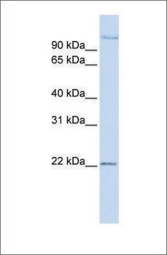 Anti-PDS5B antibody produced in rabbit affinity isolated antibody