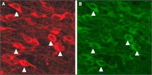 Anti-Potassium Channel SK3 (KCa3, Kcnn3, SKCa3) antibody produced in rabbit affinity isolated antibody, lyophilized powder