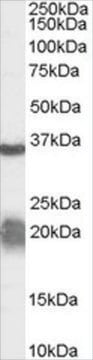 Anti-Arginase, Type 1/ARG1 (AB1) antibody produced in goat affinity isolated antibody, buffered aqueous solution