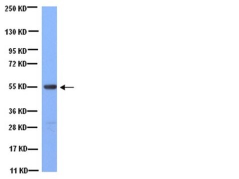 Anti-Tubulin Antibody, clone YL1/2 clone YL1/2, Chemicon&#174;, from rat