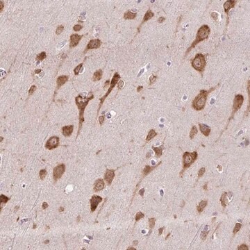 Anti-HABP4 antibody produced in rabbit Prestige Antibodies&#174; Powered by Atlas Antibodies, affinity isolated antibody, buffered aqueous glycerol solution