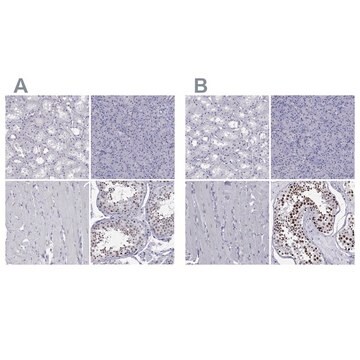 Anti-PPM1G antibody produced in rabbit Prestige Antibodies&#174; Powered by Atlas Antibodies, affinity isolated antibody, buffered aqueous glycerol solution