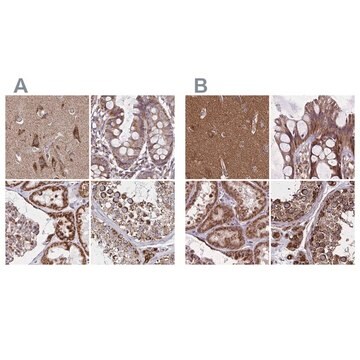 Anti-NFS1 antibody produced in rabbit Prestige Antibodies&#174; Powered by Atlas Antibodies, affinity isolated antibody, buffered aqueous glycerol solution