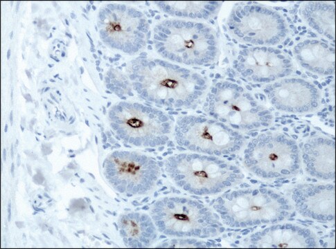 抗-DSCR1 (C-端) 兔抗 ~1.5&#160;mg/mL, affinity isolated antibody, buffered aqueous solution