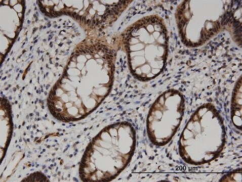 Monoclonal Anti-ACOT7, (N-terminal) antibody produced in mouse clone 1E7, purified immunoglobulin, buffered aqueous solution