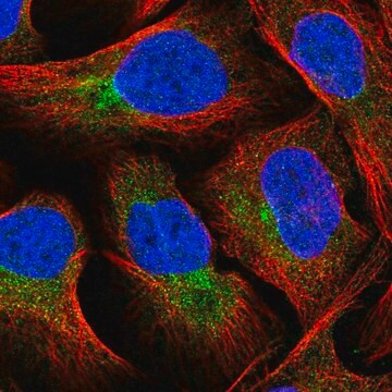 Anti-FUT8 antibody produced in rabbit affinity isolated antibody