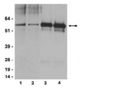 Anti-phospho-Src family (Tyr416) Antibody, clone 2N8, rabbit monoclonal culture supernatant, clone 2N8, Upstate&#174;