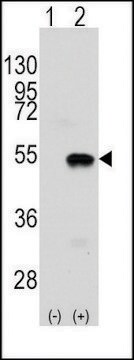 Anti-SMYD2 (N-term) antibody produced in rabbit saturated ammonium sulfate (SAS) precipitated, buffered aqueous solution