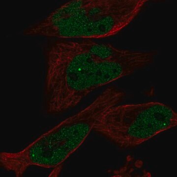 抗EYA1抗体 ウサギ宿主抗体 Prestige Antibodies&#174; Powered by Atlas Antibodies, affinity isolated antibody