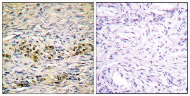 Anti-AKT antibody produced in rabbit affinity isolated antibody