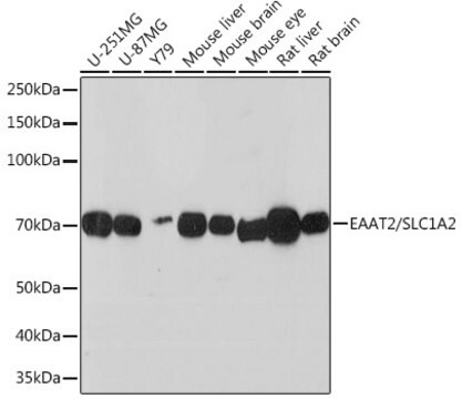 Anti-EAAT2/SLC1A2 Antibody, clone 7K5F7, Rabbit Monoclonal