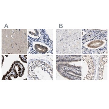 抗PGR ウサギ宿主抗体 Prestige Antibodies&#174; Powered by Atlas Antibodies, affinity isolated antibody, buffered aqueous glycerol solution