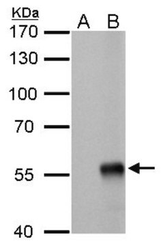 单克隆抗甲型流感病毒NP（核蛋白） 小鼠抗 clone GT778, affinity isolated antibody