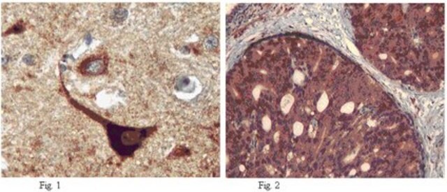 Anti-Autotaxin Antibody from rabbit, purified by affinity chromatography