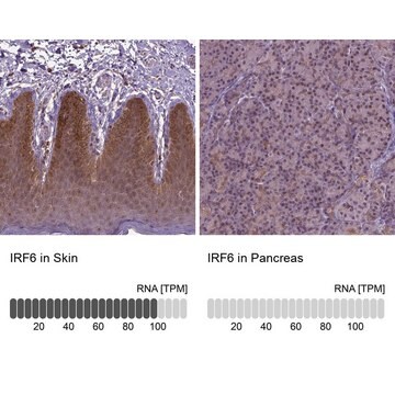 抗IRF6抗体 ウサギ宿主抗体 Prestige Antibodies&#174; Powered by Atlas Antibodies, affinity isolated antibody, buffered aqueous glycerol solution